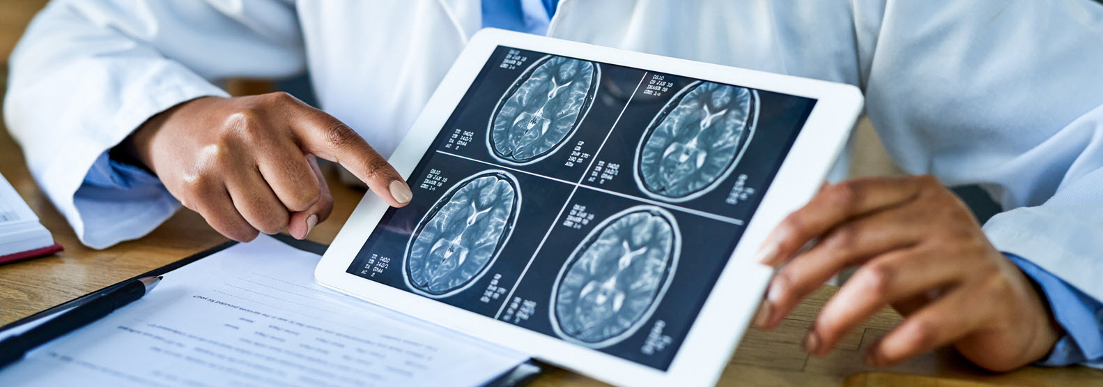 photo of medical worker holding a tablet with brain scan images